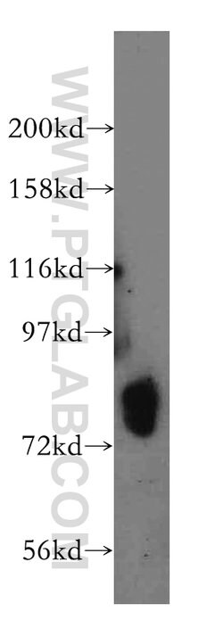 HLCS Rabbit anti-Human, Mouse, Rat, Polyclonal, Proteintech 150 &mu;L;