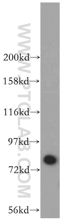 HLCS Rabbit anti-Human, Mouse, Rat, Polyclonal, Proteintech 150 &mu;L;