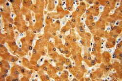 SLC27A2 Rabbit anti-Human, Mouse, Rat, Polyclonal, Proteintech 150 &mu;L;