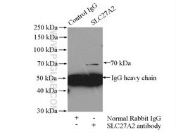 SLC27A2 Rabbit anti-Human, Mouse, Rat, Polyclonal, Proteintech 150 &mu;L;
