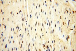USP16 Rabbit anti-Human, Mouse, Rat, Polyclonal, Proteintech:Antibodies:Primary