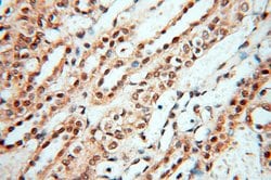 USP16 Rabbit anti-Human, Mouse, Rat, Polyclonal, Proteintech:Antibodies:Primary