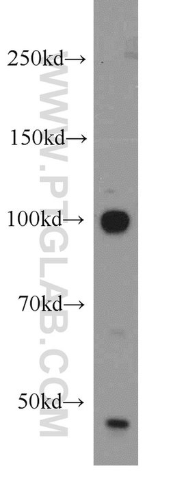USP16 Rabbit anti-Human, Mouse, Rat, Polyclonal, Proteintech:Antibodies:Primary
