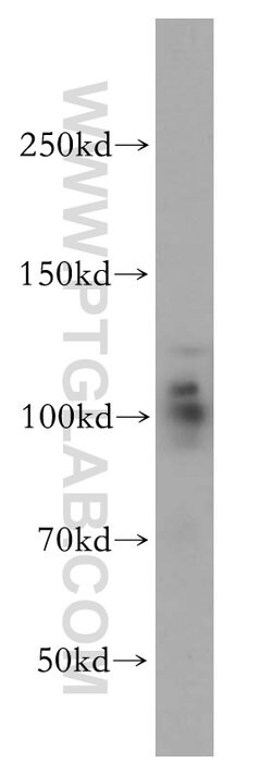 USP16 Rabbit anti-Human, Mouse, Rat, Polyclonal, Proteintech:Antibodies:Primary