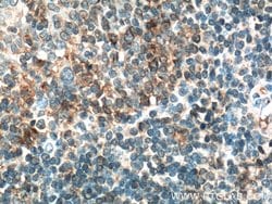 CD200 Rabbit anti-Human, Mouse, Rat, Polyclonal, Proteintech:Antibodies:Primary