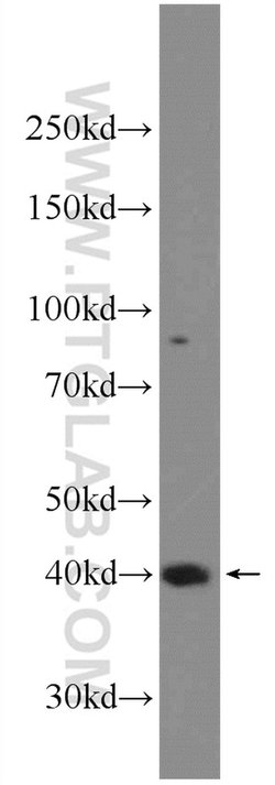 SETD8 Rabbit anti-Human, Mouse, Polyclonal, Proteintech 20 &mu;L; Unconjugated:Antibodies,
