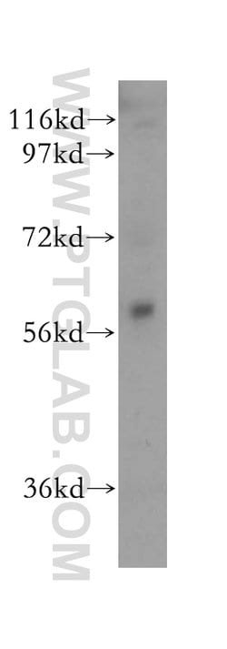 AMIGO2 Rabbit anti-Human, Mouse, Rat, Polyclonal, Proteintech 150 &mu;L;
