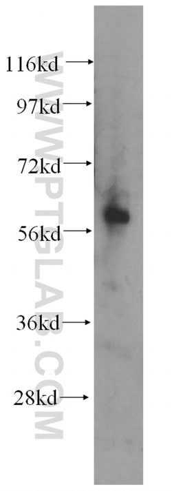 AMIGO2 Rabbit anti-Human, Mouse, Rat, Polyclonal, Proteintech 150 &mu;L;