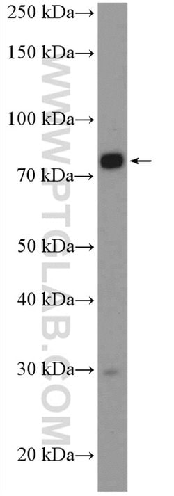 SLC5A11 Rabbit anti-Human, Polyclonal, Proteintech:Antibodies:Primary Antibodies