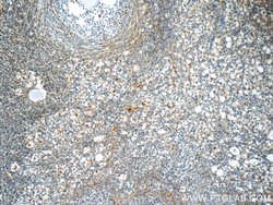 ACBD3 Rabbit anti-Human, Mouse, Rat, Polyclonal, Proteintech:Antibodies:Primary