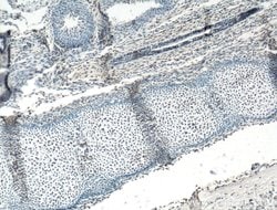 ARNT/HIF1B Rabbit anti-Human, Mouse, Polyclonal, Proteintech 150 &mu;L;