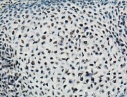 ARNT/HIF1B Rabbit anti-Human, Mouse, Polyclonal, Proteintech 150 &mu;L;
