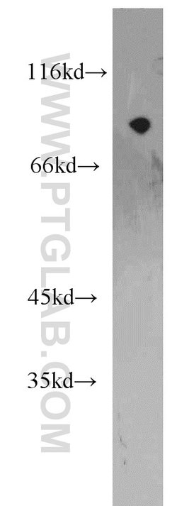 ARNT/HIF1B Rabbit anti-Human, Mouse, Polyclonal, Proteintech 150 &mu;L;