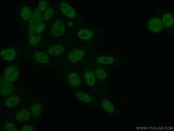 ARNT/HIF1B Rabbit anti-Human, Mouse, Polyclonal, Proteintech 150 &mu;L;