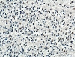 ARNT/HIF1B Rabbit anti-Human, Mouse, Polyclonal, Proteintech 150 &mu;L;