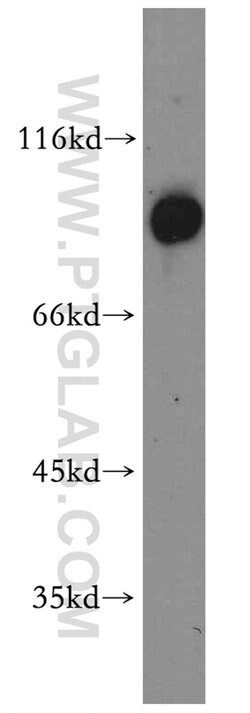 ARNT/HIF1B Rabbit anti-Human, Mouse, Polyclonal, Proteintech 150 &mu;L;
