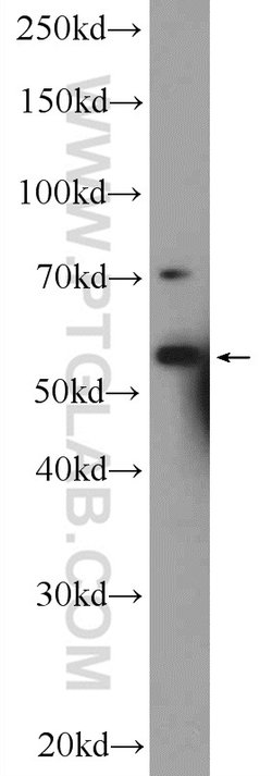 RNF8 Rabbit anti-Human, Mouse, Rat, Polyclonal, Proteintech 150 &mu;L;