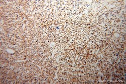 ATP5J Rabbit anti-Human, Mouse, Rat, Polyclonal, Proteintech:Antibodies:Primary