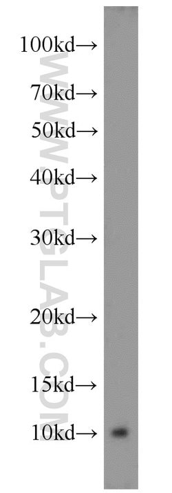 ATP5J Rabbit anti-Human, Mouse, Rat, Polyclonal, Proteintech:Antibodies:Primary