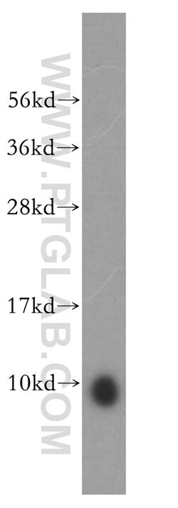 ATP5J Rabbit anti-Human, Mouse, Rat, Polyclonal, Proteintech:Antibodies:Primary