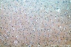 APC4 Rabbit anti-Human, Mouse, Rat, Polyclonal, Proteintech:Anticorps:Anticorps