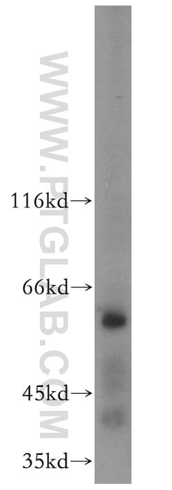 APC4 Rabbit anti-Human, Mouse, Rat, Polyclonal, Proteintech:Anticorps:Anticorps