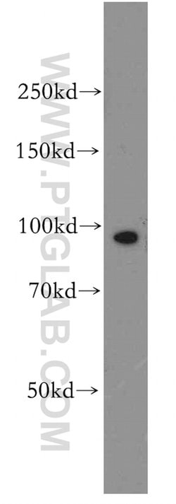 APC4 Rabbit anti-Human, Mouse, Rat, Polyclonal, Proteintech:Anticorps:Anticorps