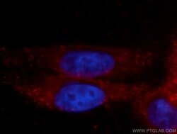 GFPT1 Rabbit anti-Human, Mouse, Rat, Zebrafish, Polyclonal, Proteintech