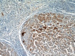 GFPT1 Rabbit anti-Human, Mouse, Rat, Zebrafish, Polyclonal, Proteintech