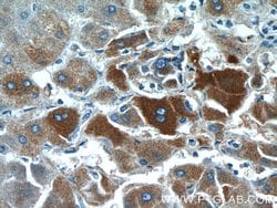 GFPT1 Rabbit anti-Human, Mouse, Rat, Zebrafish, Polyclonal, Proteintech