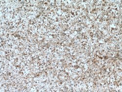 GFPT1 Rabbit anti-Human, Mouse, Rat, Zebrafish, Polyclonal, Proteintech