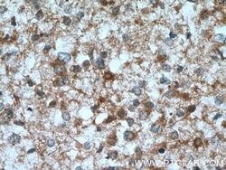 GFPT1 Rabbit anti-Human, Mouse, Rat, Zebrafish, Polyclonal, Proteintech