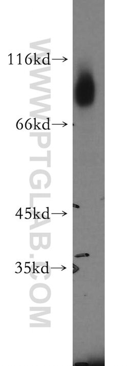 GFPT1 Rabbit anti-Human, Mouse, Rat, Zebrafish, Polyclonal, Proteintech