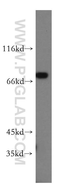 GFPT1 Rabbit anti-Human, Mouse, Rat, Zebrafish, Polyclonal, Proteintech
