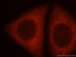 ADAM12 Rabbit anti-Human, Mouse, Polyclonal, Proteintech 20 &mu;L; Unconjugated:Antibodies,