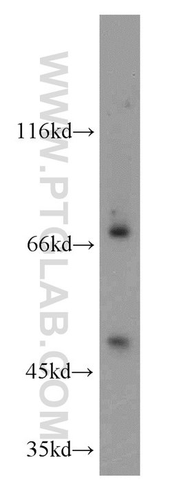 ADAM12 Rabbit anti-Human, Mouse, Polyclonal, Proteintech 20 &mu;L; Unconjugated:Antibodies,