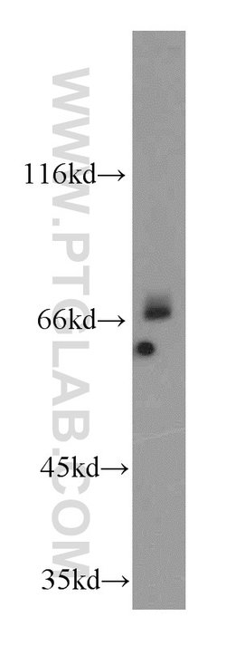 ADAM12 Rabbit anti-Human, Mouse, Polyclonal, Proteintech 20 &mu;L; Unconjugated:Antibodies,