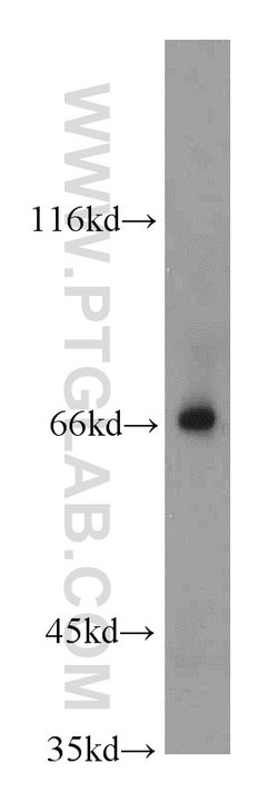 ADAM12 Rabbit anti-Human, Mouse, Polyclonal, Proteintech 20 &mu;L; Unconjugated:Antibodies,