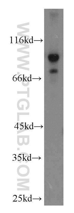 ADAM12 Rabbit anti-Human, Mouse, Polyclonal, Proteintech 20 &mu;L; Unconjugated:Antibodies,