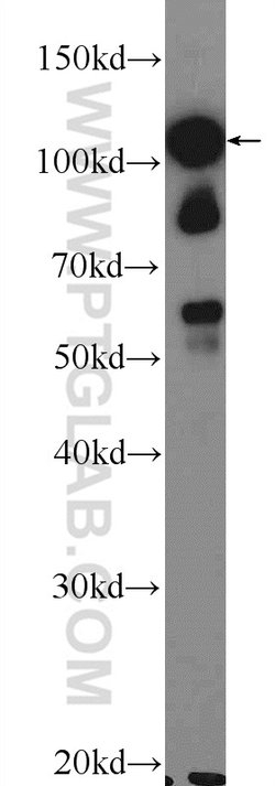 STK31 Rabbit anti-Human, Mouse, Rat, Polyclonal, Proteintech:Antibodies:Primary