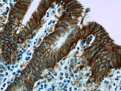 VSIG1 Rabbit anti-Human, Polyclonal, Proteintech:Antibodies:Primary Antibodies