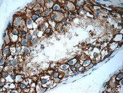 VSIG1 Rabbit anti-Human, Polyclonal, Proteintech:Antibodies:Primary Antibodies