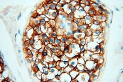 VSIG1 Rabbit anti-Human, Polyclonal, Proteintech:Antibodies:Primary Antibodies
