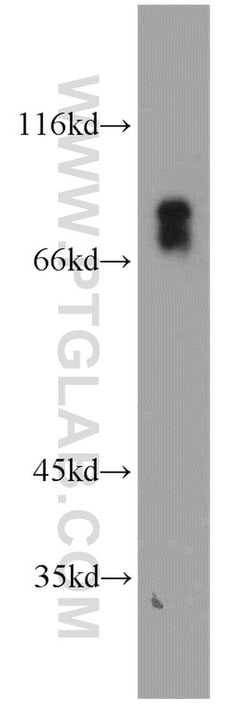 VSIG1 Rabbit anti-Human, Polyclonal, Proteintech:Antibodies:Primary Antibodies