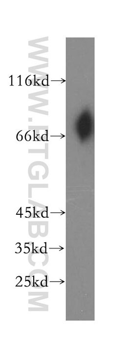 VSIG1 Rabbit anti-Human, Polyclonal, Proteintech:Antibodies:Primary Antibodies