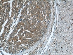 RP2 Rabbit anti-Human, Mouse, Rat, Polyclonal, Proteintech 150 &mu;L; Unconjugated:Antibodies,