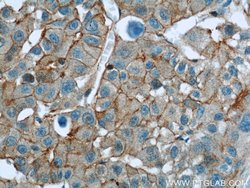 RP2 Rabbit anti-Human, Mouse, Rat, Polyclonal, Proteintech 150 &mu;L; Unconjugated:Antibodies,