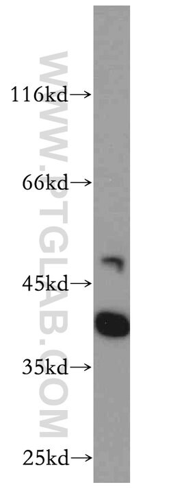 RP2 Rabbit anti-Human, Mouse, Rat, Polyclonal, Proteintech 150 &mu;L; Unconjugated:Antibodies,