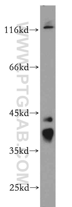 RP2 Rabbit anti-Human, Mouse, Rat, Polyclonal, Proteintech 150 &mu;L; Unconjugated:Antibodies,