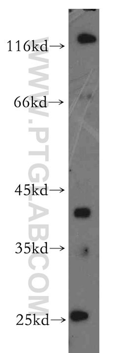 RP2 Rabbit anti-Human, Mouse, Rat, Polyclonal, Proteintech 150 &mu;L; Unconjugated:Antibodies,